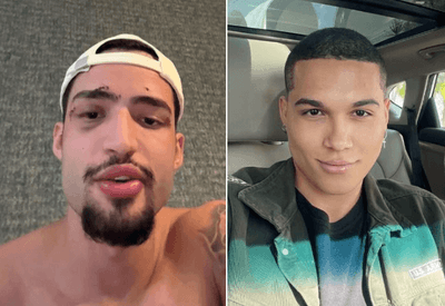 Amigo de brasileiro encontrado morto na Grécia quebra silêncio: “Simplesmente apaguei”
