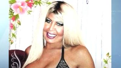 Mulher morre após aplicação clandestina de silicone industrial no RS