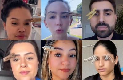 Entenda por que "truque do pregador na sobrancelha" não resolve enxaqueca