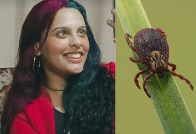 Imagem da noticia Adolfo Lutz confirma morte de adolescente por febre maculosa
