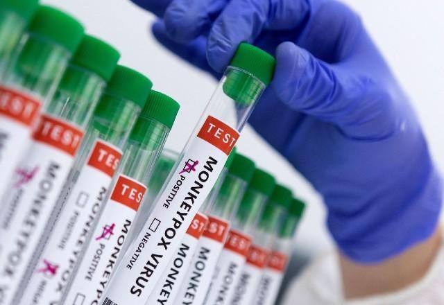 Imagem da noticia Testagem de varíola dos macacos é feita por meio de lesões e swab; entenda