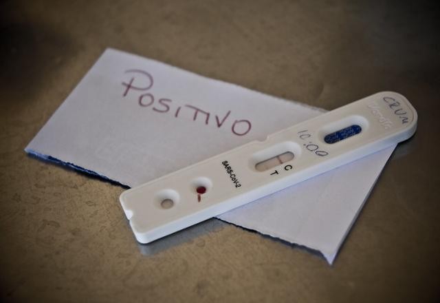 Imagem da noticia Brasil registra mais de 40 mil novos casos de covid em 24 horas