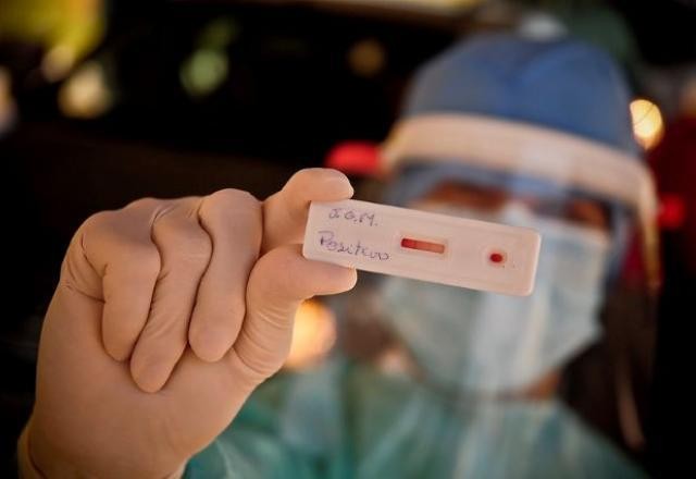 Imagem da noticia Brasil ultrapassa marca de 30 milhões de casos de covid-19