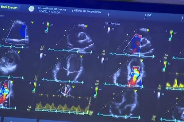 Imagem da noticia Anvisa aprova venda de medicamento para insuficiência cardíaca