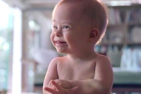 Imagem da noticia Bebê com Síndrome de Down vira sucesso na internet