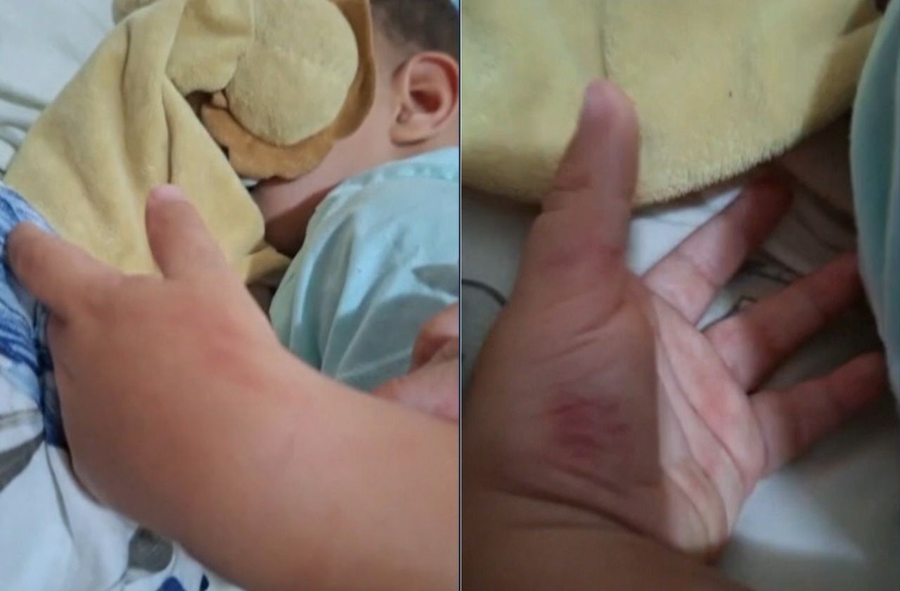 Imagem da noticia Polícia do RS investiga maus-tratos em creche após bebê de 1 ano aparecer com lesões 