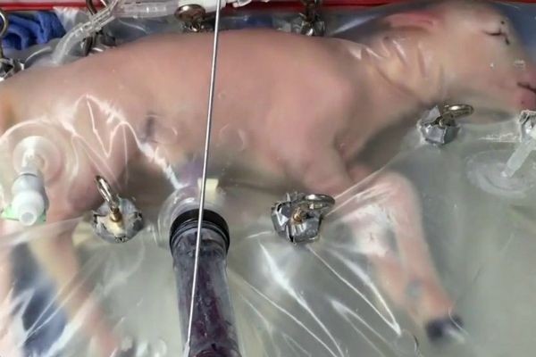 Imagem da noticia Cientistas desenvolvem útero artificial que pode ajudar bebês prematuros