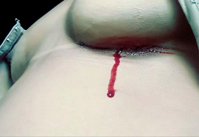 Imagem da noticia Sonhos cortados: o pesadelo da medicina estética na capital federal