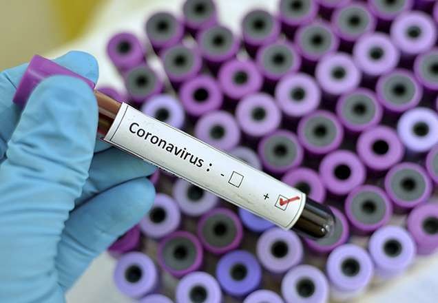 Imagem da noticia Coronavírus: Adolescente sem sintomas da doença é o 4° caso confirmado no Brasil