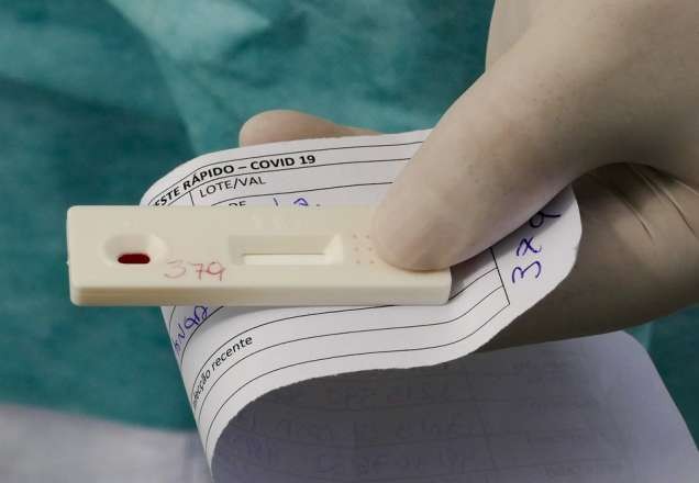 Imagem da noticia Coronavírus: Bolsonaro aprova lei que prioriza testes para profissionais essenciais