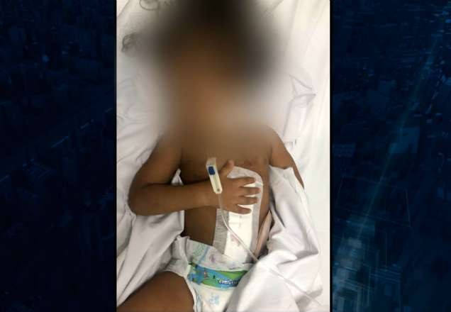 Imagem da noticia Criança perde o baço após ser espancada; mãe é principal suspeita