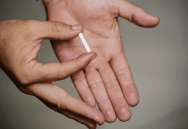 Imagem da noticia Anvisa proíbe hormônios implantáveis conhecidos como "chips da beleza"