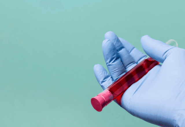 Imagem da noticia Como a descoberta de um novo tipo sanguíneo pode revolucionar as transfusões de sangue