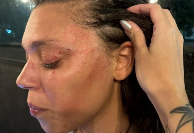 Imagem da noticia Mulher leva soco na saída de banheiro feminino; agressor a confundiu com trans