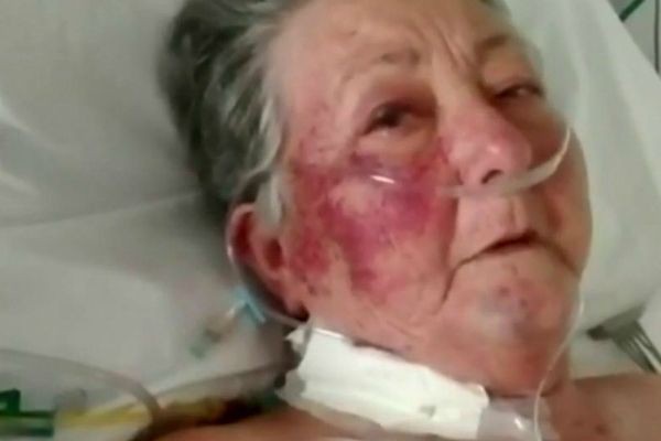 Imagem da noticia Enfermeiro agride idosa de 78 anos em cama de UTI