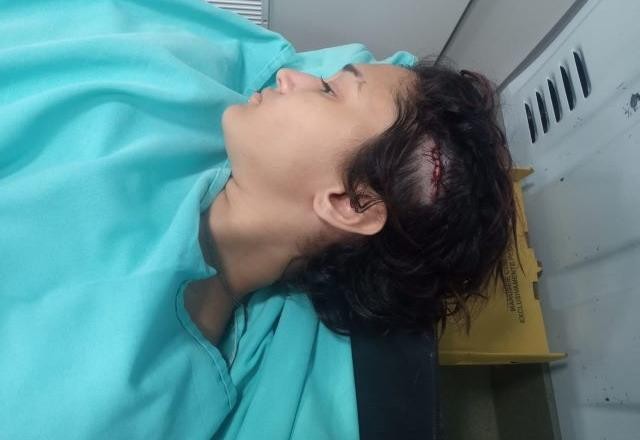 Imagem da noticia Jovem é atingida com paulada após criticar Bolsonaro, no Rio