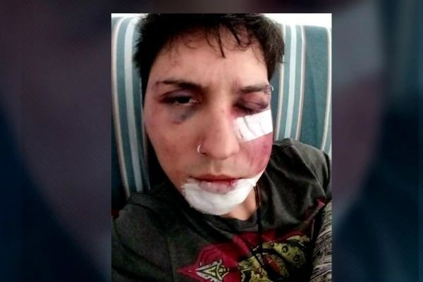 Imagem da noticia Estudante da Anhembi Morumbi é espancado em festa de trote 