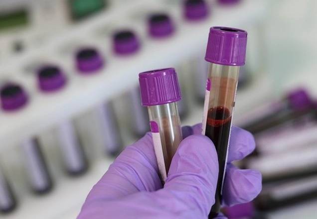 Imagem da noticia Exames de sangue podem identificar casos mortais de Covid-19