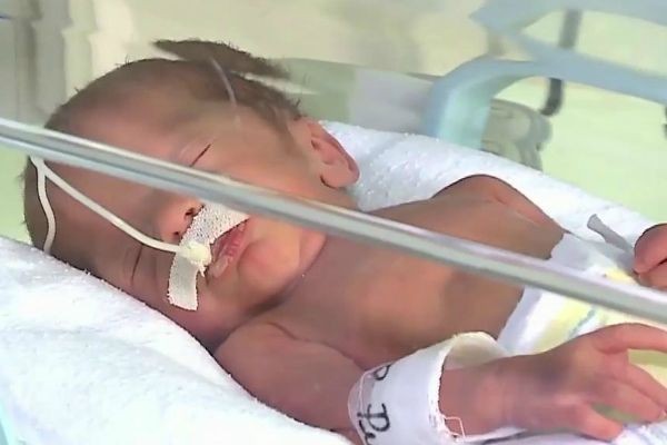 Imagem da noticia Família visita as primeiras quadrigêmeas nascidas em 2018 no país