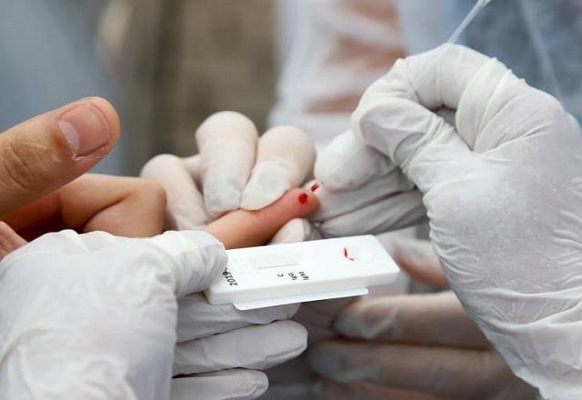 Imagem da noticia Covid-19: país registra mais 10.055 casos e 233 mortes em 24 horas