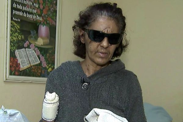 Imagem da noticia Homem que cortou as mãos e cegou a própria esposa continua foragido