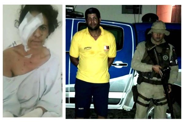 Imagem da noticia Homem que cegou e decepou as mãos da própria esposa é preso