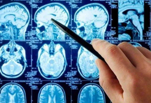 Imagem da noticia Pesquisa revela neurônios relacionados à compulsão alimentar