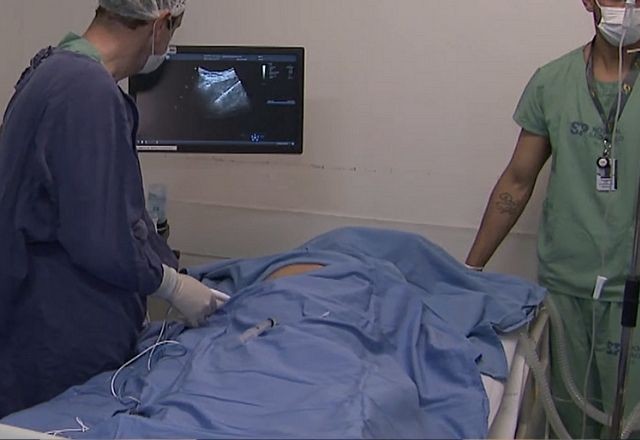 Imagem da noticia Cirurgia sem cortes: Radiologistas defendem inclusão da "ablação" na cobertura do SUS