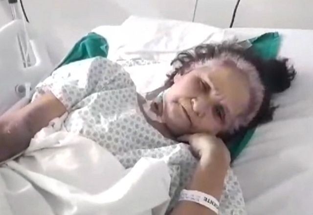 Imagem da noticia Idosa de 61 anos morre após mais de 1 ano em fila de espera por cirurgia