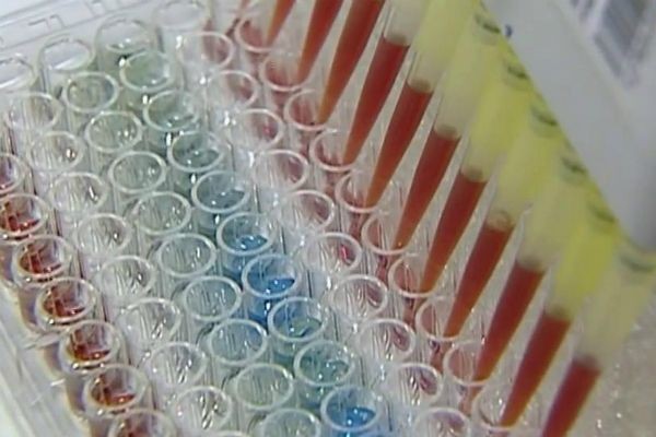 Imagem da noticia Infecções por HIV aumentaram no Brasil