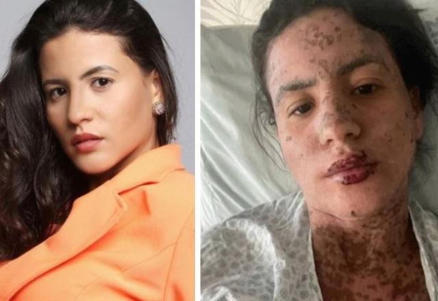 Imagem da noticia Mulher de Frank Aguiar revela que passou 10 dias na UTI por causa de doença rara