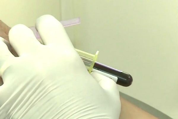 Imagem da noticia Isenção em concursos públicos para doadores de medula divide opiniões