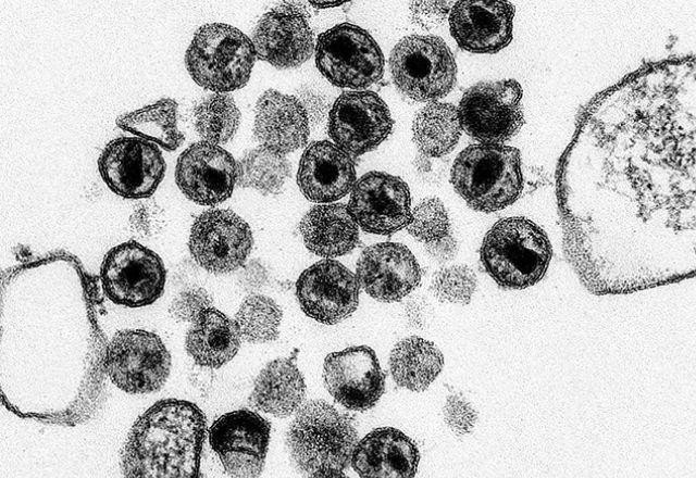 Vacina mata HIV em macacos e pesquisadores planejam testes em humanos