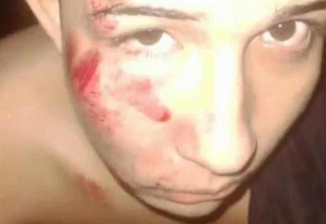 Imagem da noticia Lutadores de MMA suspeitos de espancar rapaz têm prisão decretada no Rio