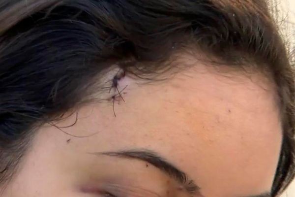 Imagem da noticia Jovem é atingida na cabeça por pedrada dentro de ônibus em SP