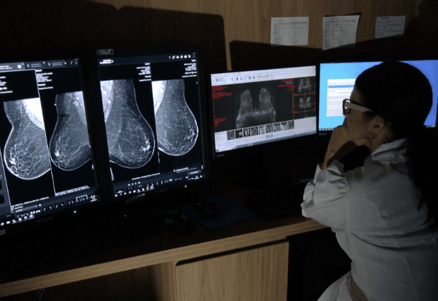 Imagem da noticia ANS amplia faixa etária para mamografia na rede privada