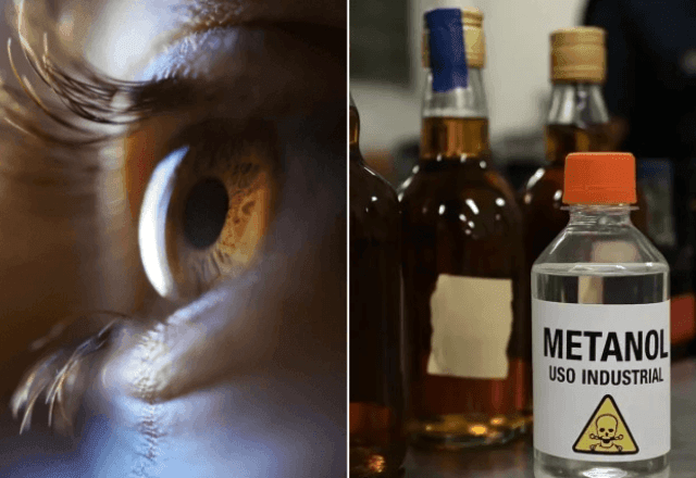 Imagem da noticia Cegueira causada por intoxicação de metanol é permanente? Médicos explicam efeitos da contaminação
