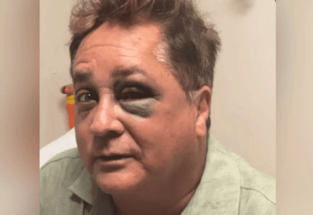 Imagem da noticia Leonardo sofre queda no Pantanal e esposa atualiza estado de saúde do cantor