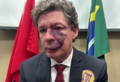 "Quem trabalha menos, produz mais", diz autor de proposta pelo fim da escala 6x1