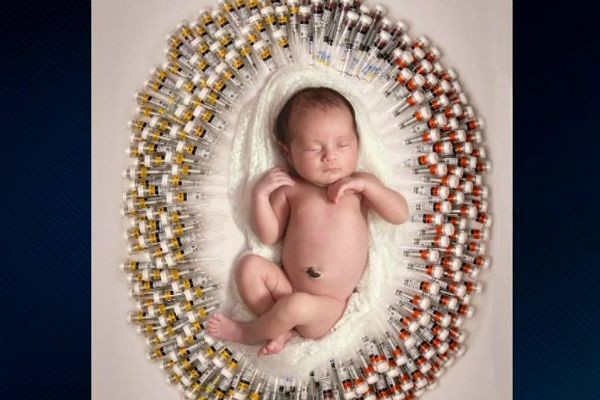 Imagem da noticia Mãe faz fotos do bebê com seringas usadas durante a gravidez