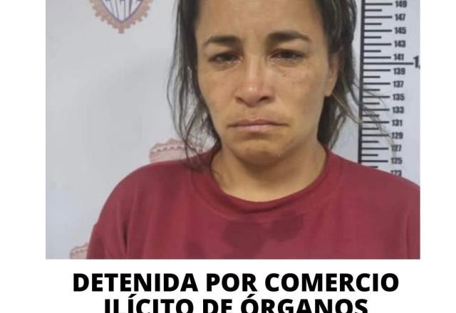 Imagem da noticia Mulher que vendia rins humanos no Facebook é presa na Venezuela