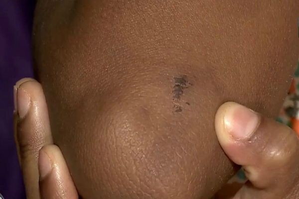 Imagem da noticia Menina atropelada ao descer de van escolar tem ferimentos leves 