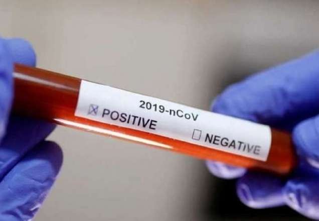 Ministério da Saúde confirma 621 casos de coronavírus no Brasil
