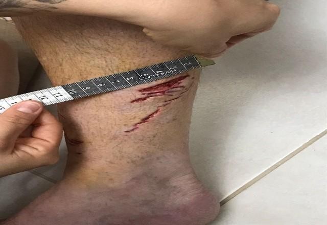 Imagem da noticia Turista francês é mordido por tubarão em praia de Ubatuba (SP)