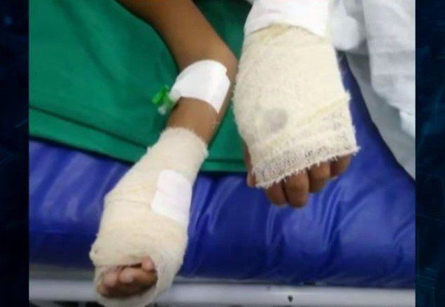 Imagem da noticia Mulher confessa ter jogado óleo quente no filho de 8 anos e é presa