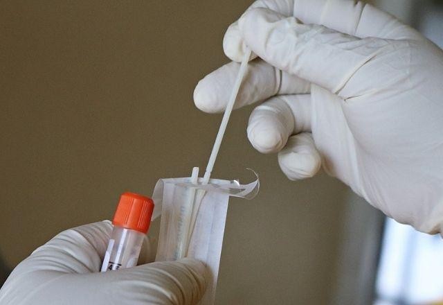 SP inicia dupla testagem para identificar casos de covid e influenza