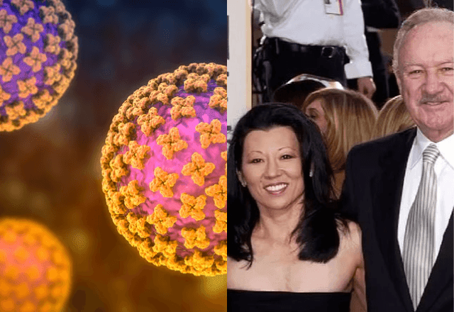 Imagem da noticia Hantavírus: entenda doença que matou Betsy Arakawa, esposa de Gene Hackman