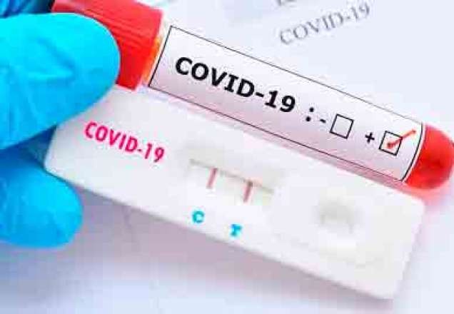 Imagem da noticia Novo exame contra Covid-19 é mais confiável que o teste rápido