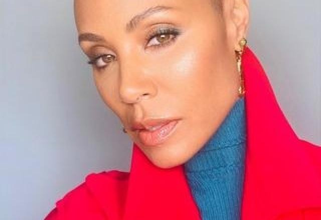 Imagem da noticia Alopecia: doença de Jada Pinkett Smith é comum antes dos 30 anos