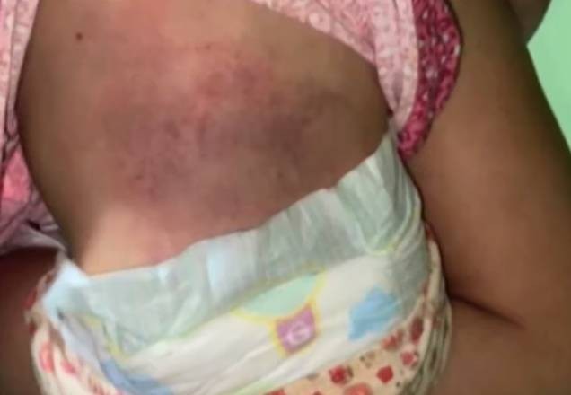 Imagem da noticia PR: mãe perde guarda da filha após espancamento com fio de carregador